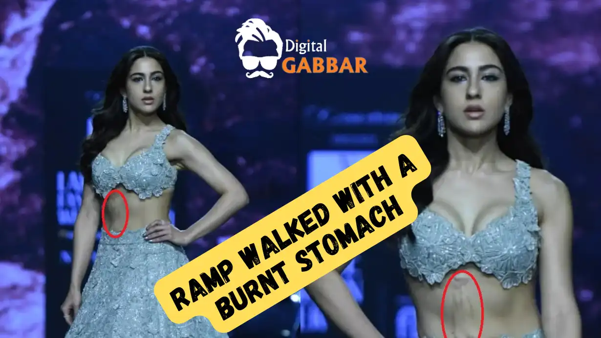 Sara Ali Khan ramp walked with a burnt stomach, fans were in an uproar!