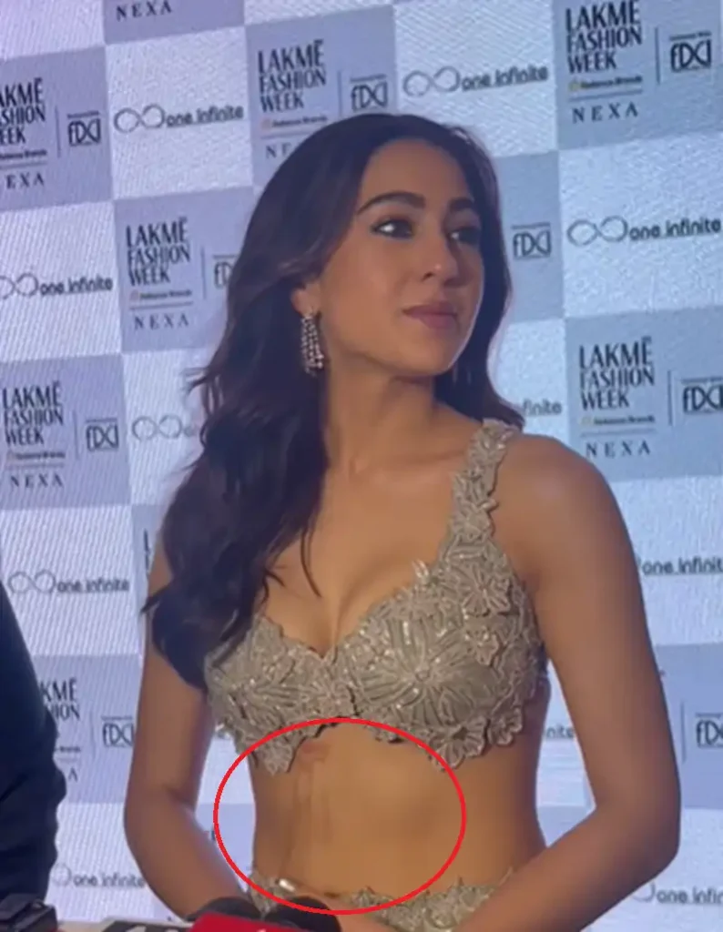 Sara Ali Khan Ramp Walked With A Burnt Stomach, Fans Were In An Uproar! 90 ramp walked with a burnt stomach