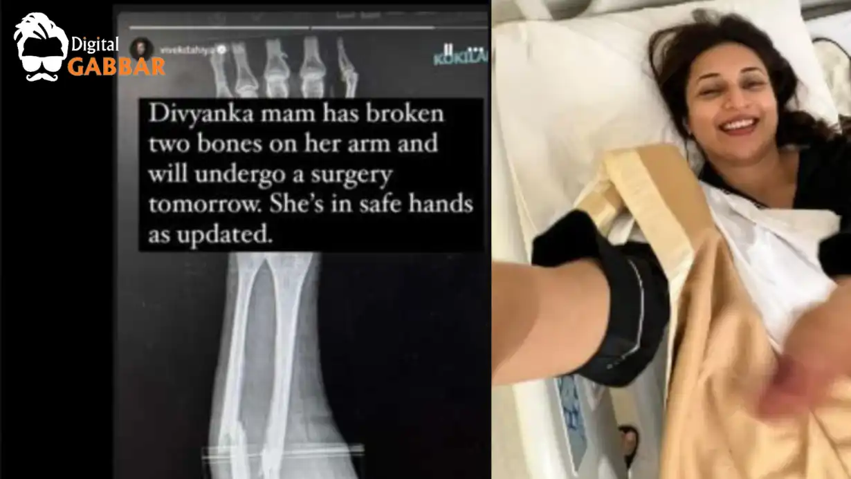 Divyanka Tripathi Injured in Accident; Vivek Dahiya Cancels Live Session, Rushes to Hospital
