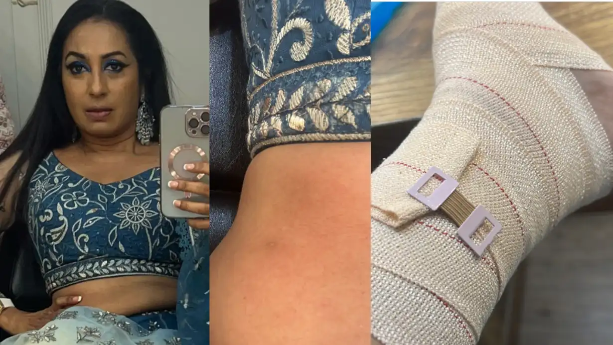 Kashmera Shah's Accident: Injured with Multiple Fractures, Blames 'Evil Eye' 87 Kashmera Shah's Accident Injured with Multiple Fractures, Blames 'Evil Eye'