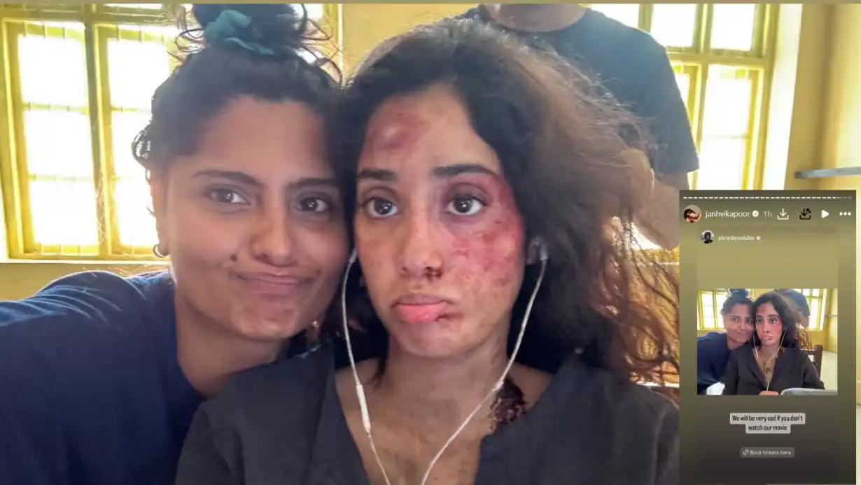 Janhvi Kapoor's Deep Injury on Her Face! Fans Worried Seeing the Actress's Condition 85 Janhvi Kapoor's Deep Injury on Her Face! Fans Worried Seeing the Actress's Condition