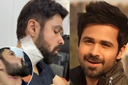 Emraan Hashmi Suffers Serious Injury On The Sets Of ‘godachari 2’