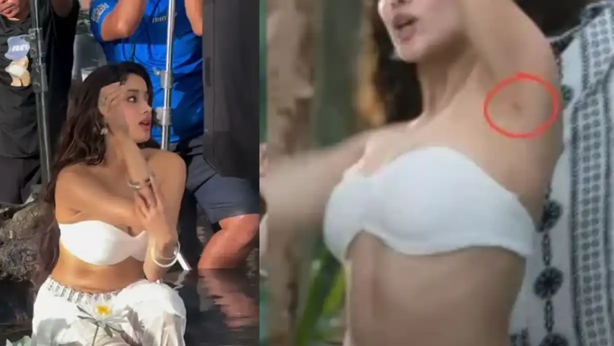 Did Janhvi Kapoor Undergo Surgery? Fans Spot Scars in 'Chuttumalle' Song 85 Did Janhvi Kapoor Undergo Surgery Fans Spot Scars In 'chuttumalle' Song