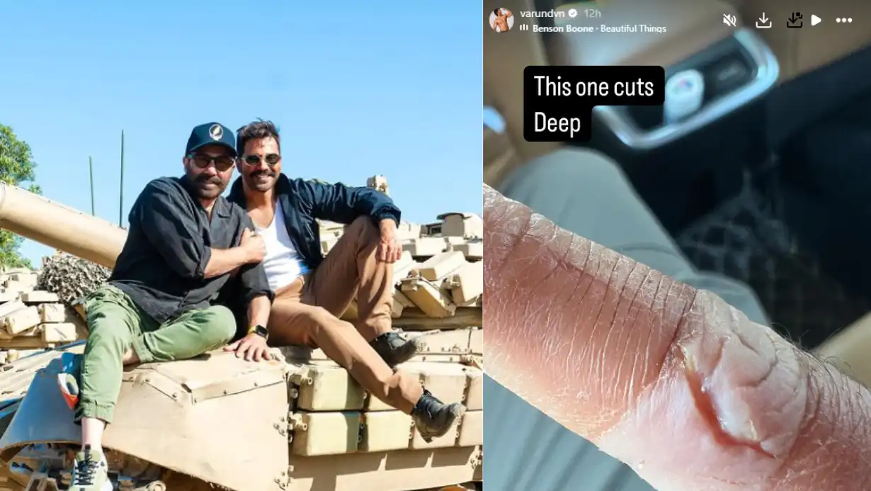Varun Dhawan Injured on 'Border 2' Set, Shares Deep Wound Image 86 Varun Dhawan Injured On 'border 2' Set, Shares Deep Wound Image