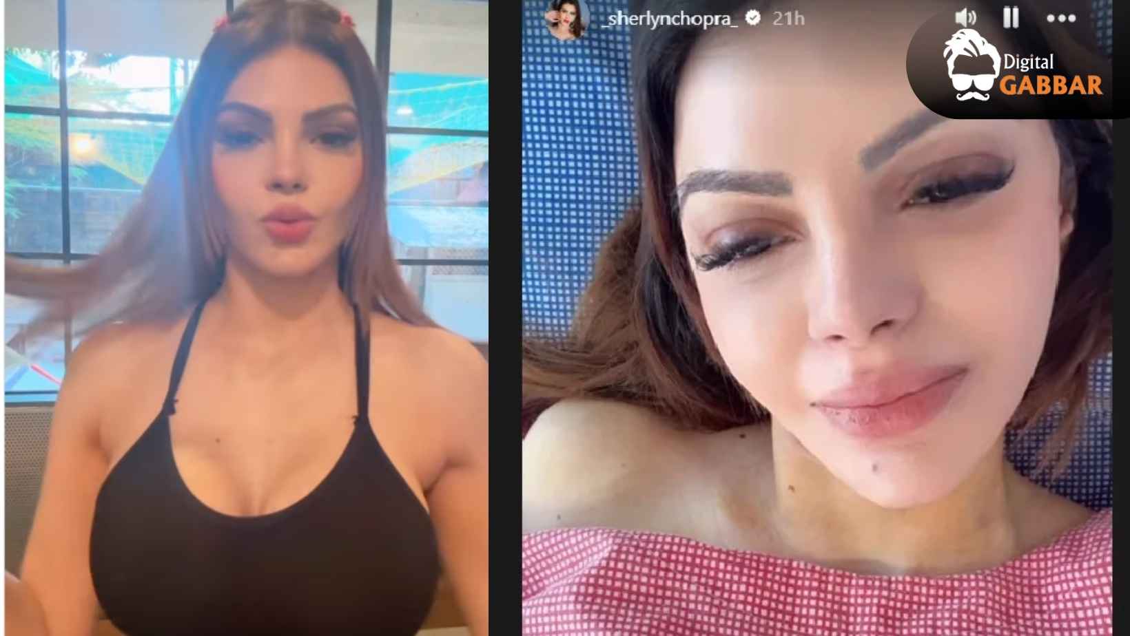 Sherlyn Chopra’s Bold Decision: Actress Removes Heavy Breast Implants After Painful Struggle 74 Sherlyn Chopra Breast Implant Removal Surgery